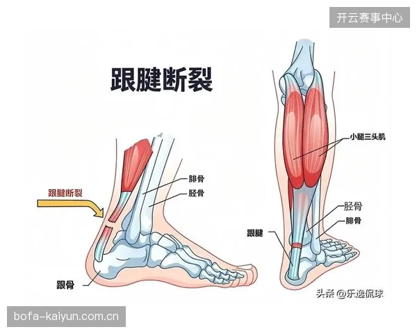 法国队锋线储备受损，新星埃基蒂克遭遇跟腱断裂重伤将长期缺阵